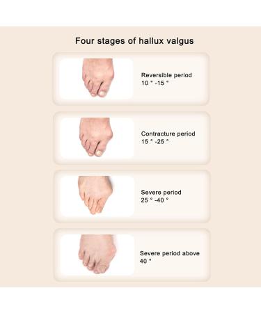 Adjustable Hallux Valgus Corrector - Orthopedic Bunion Rail with PU Pads & ABS Support - Green - Buy Online on GoSupps.com