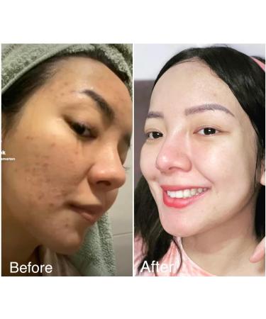 Rosmar Kagayaku Bleaching Cream - Buy Online on GoSupps.com