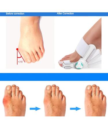 Lmeil Bunion Orthoses - Big Toe Straightener & Corrector | Hallux Valgus Relief for Men & Women - Buy Online on GoSupps.com
