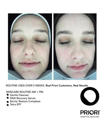 Priori Skincare TETRA SPF 55 Lotion 1.7 fl oz - Broad Spectrum Sun Protection - Buy Online on GoSupps.com