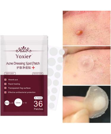 Acne Dressing Spot Patch Acne Paste Transparent Pimple Patch Breathable Painless Acne Treatment Gel Patch Skin Care Absorb Pus Rapid Healing Effective Antibacterial Protection 36 Patches - Buy Online on GoSupps.com