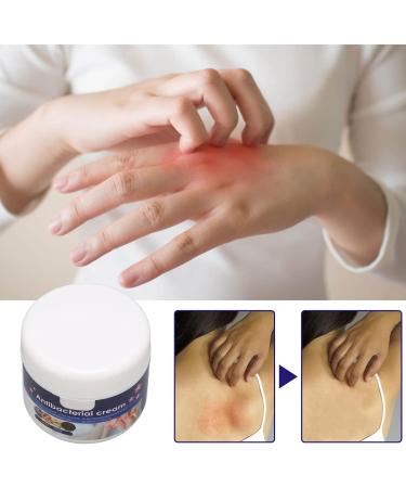30g Herba Violae Natural Plant Anti-Itch Cream for Mosquito Bites & Skin Itch Relief - Buy Online on GoSupps.com