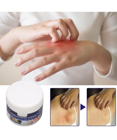 30g Anti Itch Hydrating Cream for Fast Relief of Skin Irritation and Dryness - Buy Online on GoSupps.com