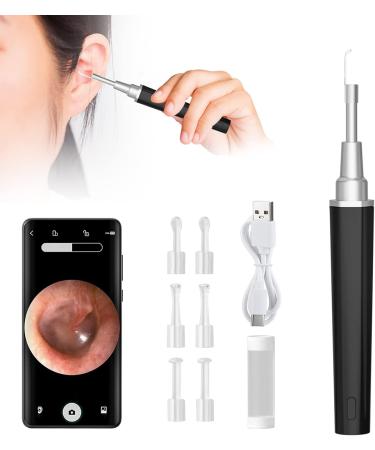 1080p HD Digital Otoscope Camera with Light - Ear Wax Removal WiFi Endoscope for iPhone iPad & Android - IP67 Waterproof 3.9mm Ultra-Thin Design (Black) - Buy Online on GoSupps.com