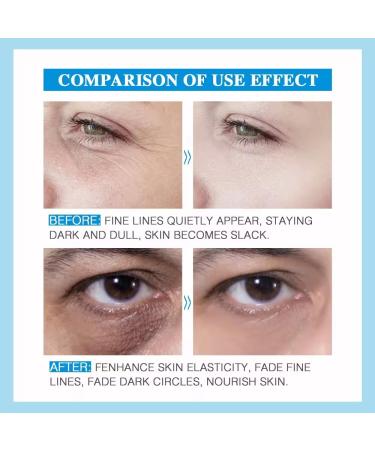 Miracle Instant Eye Lift Cream | Anti-Wrinkle Eye Cream for Youthful Skin - Shop Now - Buy Online on GoSupps.com