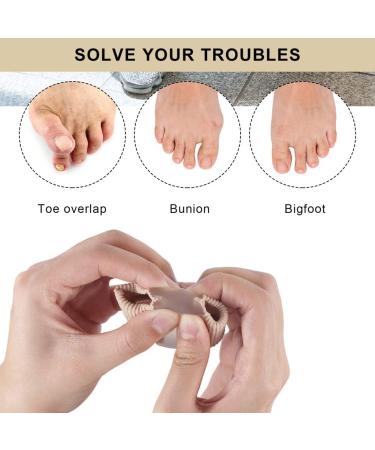 Silicone Toe Extensors & Spreaders for Hallux Valgus - 2-Piece Corrective Toe Separator for Men & Women - Buy Online on GoSupps.com