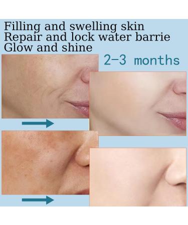 Hyaluronic Acid 5% + Vit E Best Pure Hyaluronic Acid Moisturiser for Face Anti Ageing & Anti Wrinkle Moisturiser Hyaluronic Acid Serum Fine Lines & Sensitive Skin Improve Age Spots (30 ML) - Buy Online on GoSupps.com