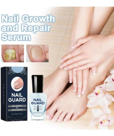 Nail Growth And Repair Serum 1/2 Pcs Nail Guard Serum Nail Strengthening and Growth Conditioner Nail Strengthener and Growth and Repair (2Pcs) - Buy Online on GoSupps.com