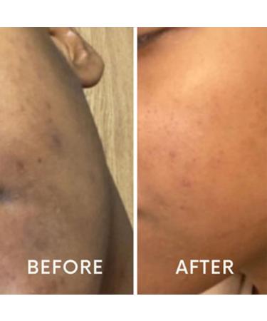 Nizma Skincare CC Serum with Vitamin C Hydrating Face Serum with Hyaluronic Acid and Citrus Stem Cells for All Skin Types Reduces Redness and Age Spots 1 oz. - Buy Online on GoSupps.com
