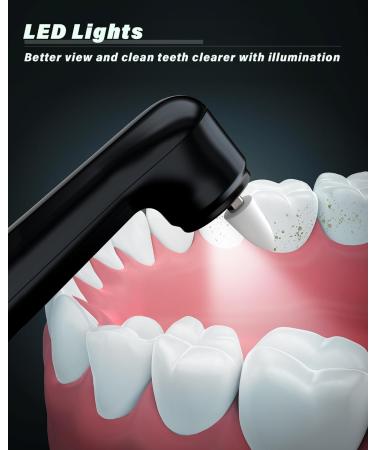 Tooth Whitening Set - Stim-U-Dent Bleaching Kit with 5 Modes 5 Heads & 3 Polishing Pastes for Superior Teeth Cleaning & Whitening - Buy Online on GoSupps.com