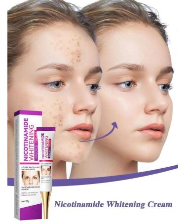 Cremas Para Las Manchas de La Cara Oscuras Para Eliminar Manchas en la Cara Crema Para Quitar Manchas de la Cara Crema Blanqueadora Para Pecas - Buy Online on GoSupps.com