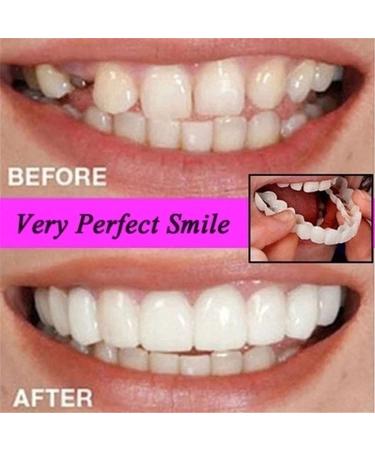 FCcassiel False Teeth Magic Brace Cover Veneers 2 Pairs for Men Women - Beautiful Smile Dentures Fake White - Whitening Alternative - Pack of 1 - Buy Online on GoSupps.com