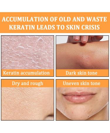 2 Pi ces Gels Exfoliants Naturels gentle exfoliating orange exfoliant doux Nettoyage en Profondeur claircissant pour Tous Types de Peau - Buy Online on GoSupps.com