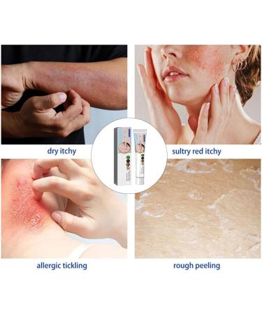 Face Cream Body Cream Anti-Itch Cream Chinese Herbal Cream Skin Repairing Cream for Face Body Cream for Itchy Skin Moisturizing Skin Cream 20 g - Buy Online on GoSupps.com