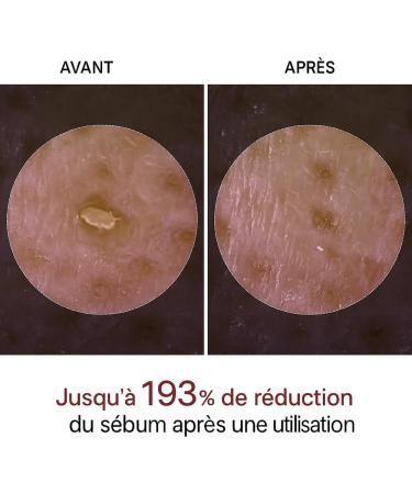 Lumeva Peel Shot Lumeva Visage Point Noir Exfoliant Visage Cor en - S rum Exfoliant Riz Noir & Blanc Nettoyage Profond des Pores et Points Noirs Pour Tous Types de Peau - 80 ml 2 flacons - Buy Online on GoSupps.com