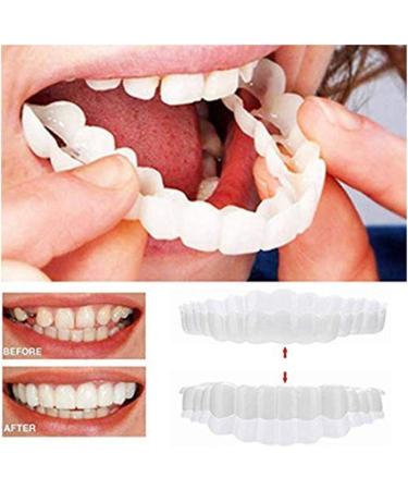 Giural Cosmetic Teeth - 2 Pairs Snap-On Veneers for Instant Perfect Smile | White Teeth Braces for Top & Bottom - Buy Online on GoSupps.com