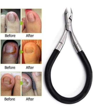 PSGS Spiral Spring Cuticle Trimmer Nippers Cleaner Nail Gap Remover Dead Skin Rescue Hangnail Paronychia Manicure Tools (Color : 4) - Buy Online on GoSupps.com