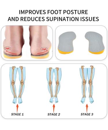 High Arch Insoles for Men & Women | Supination Correction & Orthotic Support Inserts - Y02 - Buy Online on GoSupps.com