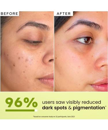 Hyphen Brightening 5% Niacinamide 1% Alpha Arbutin Face Serum | With 25% Kakadu Plum -20X More Vitamin C Serum for Glowing Skin | 56% Glow Actives for Dark Spots & Pigmentation | All Skin Types -30ml - Buy Online on GoSupps.com