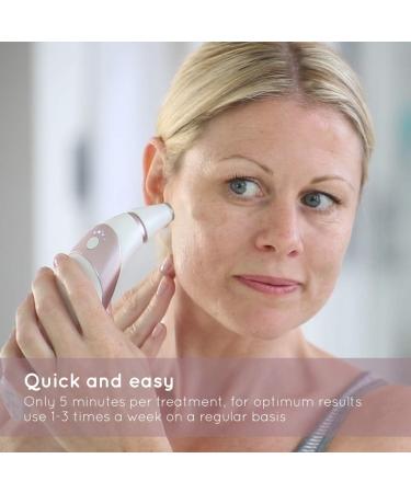 HoMedics Radiance Microdermabrasion Rose Gold - Professional Quality Salon Grade Deep Skin Exfoliation at Home Fast Treatment for Normal + Sensitive Skin Diminish Wrinkles Revitalise Skin HoMedics Radiance Microdermabrasion Rose Gold Professional Quality  - Buy Online on GoSupps.com