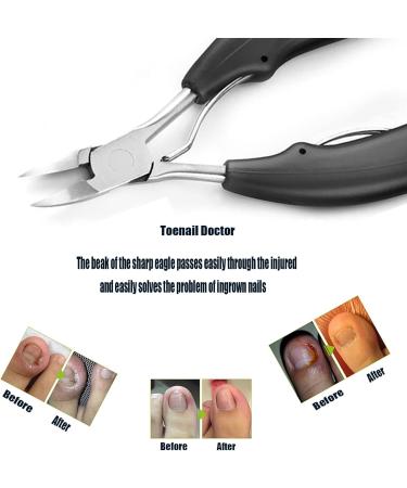 Toenail Clippers for Seniors Thick Toenails Nail Clipper Set for Men Nail Clippers for Ingrown Toenail Corrector Nail Clippers for Acrylic Nails Nail - Buy Online on GoSupps.com