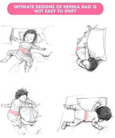 Infant Hernia Belt 2pcs - Pink | Newborn Umbilical Cord Hernia Care for Baby | Navel Protection Belt - Buy Online on GoSupps.com