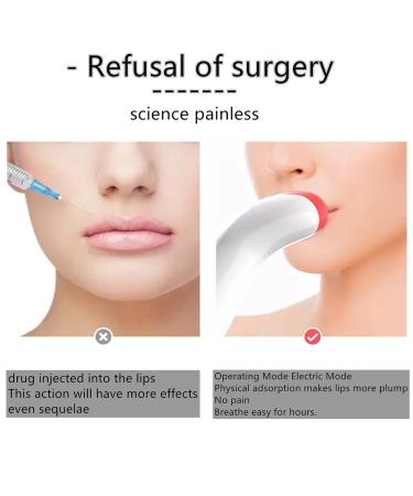 2023 Women's Electric Lip Plumper | USB Charging Lip Plumping Machine for Plumper Lips | Lip Care Tool for Girls and Women - Buy Online on GoSupps.com