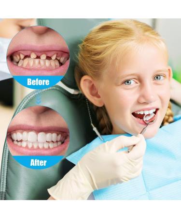 Buy CJBin 2 Pairs Lightening Immediate Veneers Teeth Set - Top & Bottom Dentures for Men & Women | Best Whitening Alternative for Bad Teeth - Buy Online on GoSupps.com