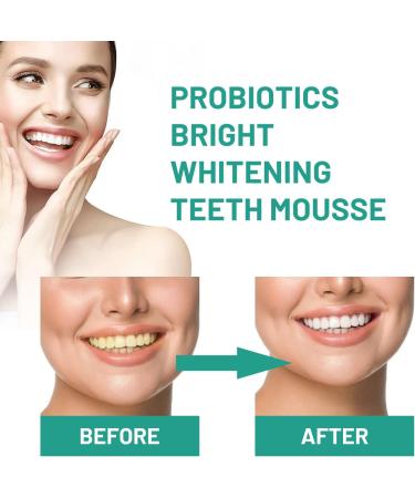 2 Stuck Bright Whitening Teeth Mousse & Toothpaste - Herbal Oral Repair Treatment Deep Cleaning & Brightening - 60ml - Buy Online on GoSupps.com