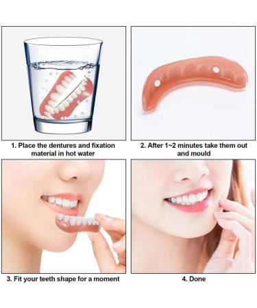 Wttfc Clipin veneers 2 pairs of false teeth veneers direct dentures adjustable click dentures clickin veneers false teeth for women and men teeth whitening covering imperfect teeth - Buy Online on GoSupps.com