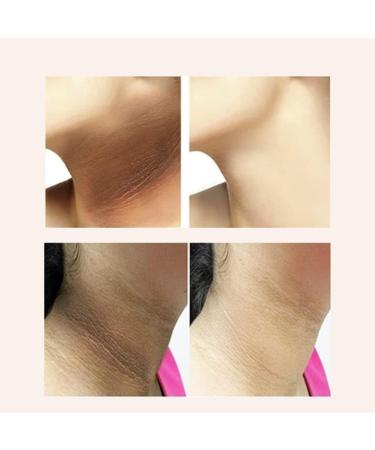Japan Neck Collagen Whitening Cream Neck Hydrolyzed Collagen Neck Cream Dark Spot Repair Cream Whitening Cream For Dark Skin - Buy Online on GoSupps.com