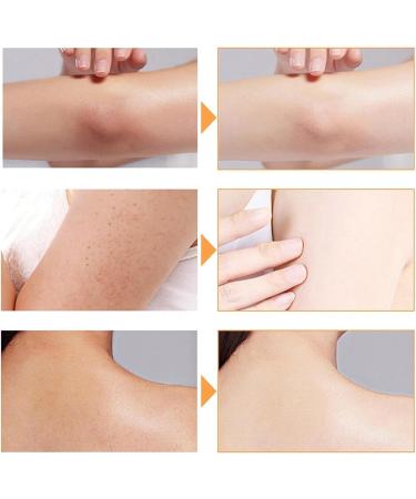  Generisch Nolvia Soap - Organic Natural Soap - Luxury Double Action Care - Handmade Vegetable Soap with Oat Oil - Organic Piece for Dry and Sensitive Skin - Refreshing Moisturizer (2) - Buy Online on GoSupps.com