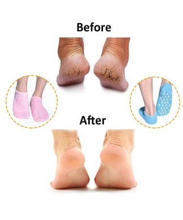 Moisturizing Gel Socks - 2 Pairs of Reusable Soft Socks with Essential Oil Treatment for Dry Skin Pink & Blue - Buy Online on GoSupps.com