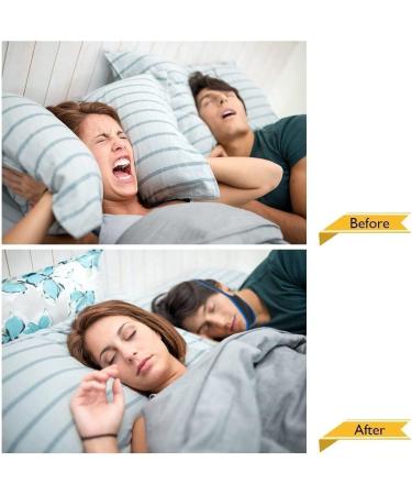 Drimm Anti Snoring Chin Strap - Adjustable Breathable Sleep Aid for Men and Women - Stop Snoring and Improve Sleep Quality! - Buy Online on GoSupps.com