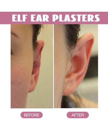 Cosmetic Ear Corrector Earring 30 Self-Adhesive Ear Patches for Protruding Ears | Discreet Elf-Ear Solution - Buy Online on GoSupps.com