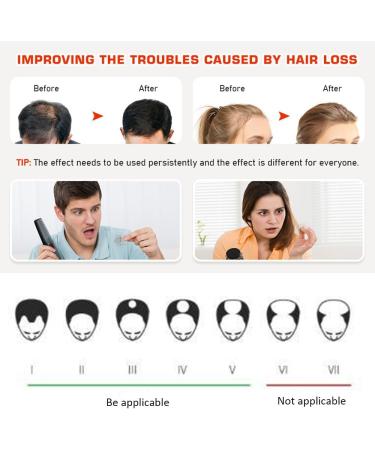 ZCBYBT Complete Scalp Treatment to Reverse Thinning for Men and Women Black One Size - Buy Online on GoSupps.com