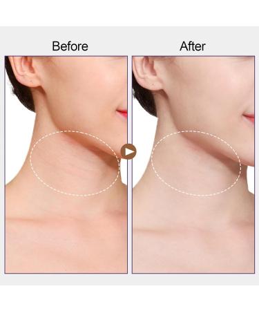 24 Pcs Neck Lift Tape Neck Tape Lifting Invisible for Face Jaw Necks Instant Necks and Face Lift Strap Patch Tightening Tapes (4 Skin Tone Bands + 20 Replacement Tapes) 4pcs Skin Color - Buy Online on GoSupps.com