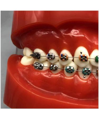 Orthodontic Teeth Model Dental Typodont with Metal Brackets & Ligature Ties - Red | International Shipping Available - Buy Online on GoSupps.com