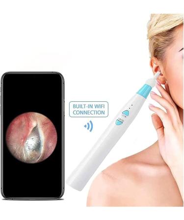JYYBN Wireless Ear Cleaner with LED Camera - Ear Wax Removal Tool for Kids & Adults - Buy Online on GoSupps.com