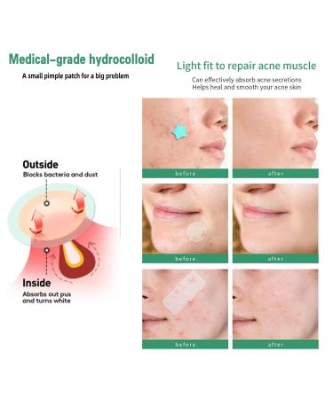 Acne Pimple Patch | Hydrocolloid Cover | 120 Pack | Star Heart Shape | Zit Breakouts & Blemish Spot Stickers - Buy Online on GoSupps.com