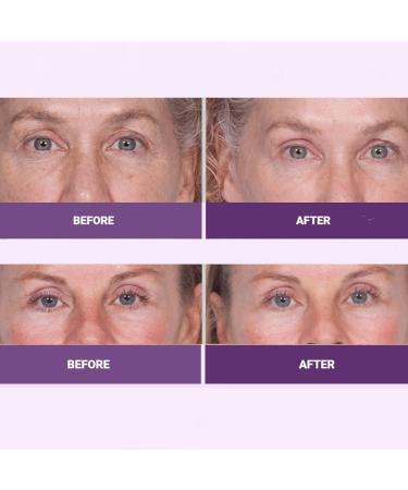 Serious Skincare INSTA-TOX Facial Firming Serum & Reverse Lift Eye Cream Bundle - Buy Online on GoSupps.com