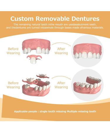 Partial Dentures - Dentures for Missing Teeth & Gaps - Lightweight & Unbreakable Replacement Teeth for Men & Women (1 Tooth) - Buy Online on GoSupps.com