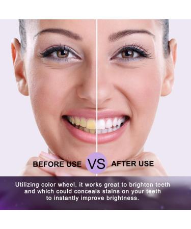 2023 New Purple Toothpaste for Teeth Whitening | Yellow Stain Removal | Teeth Whitening Kit 30ml - Buy Online on GoSupps.com