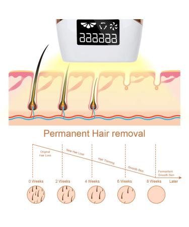 Huieter IPL Hair Removal Device - 999,999 Flashes, Permanent & Painless Laser Hair Remover for Men and Women, Facial Legs Arms Armpits Body, At-Home Use - White - Buy Online on GoSupps.com