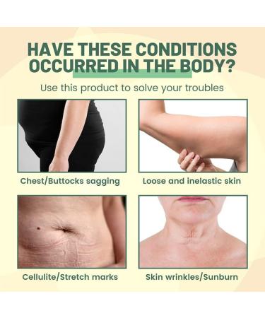 osiuujkw Women Slimming Body Oil Girls Abdomen Chest Arm Thigh Firming Lifting Antiwrinkle Oils Wrinkle Remover Skin Care - Buy Online on GoSupps.com