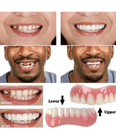 Buy Batlam Silicone Prostheses - Cosmetic Veneer Natural Color Comfortable Fit Upper & Lower Teeth (4 Pairs) | International Shipping - Buy Online on GoSupps.com