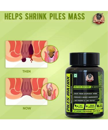 Hemorrhoid Treatment Supplement - Natural Relief for Itching Burning & Discomfort | 100% Vegetarian Capsules - Buy Online on GoSupps.com