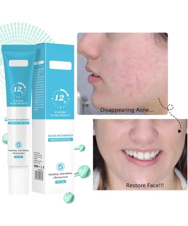 Acne Treatment Cream Spot Treatment Acne Cream Soothing & Anti redness Excellent Osmotic Force for All Kinds of Acne and Pimples White Head Inflamed Hardened Encysted Acnes Water-Oil Balance - Buy Online on GoSupps.com