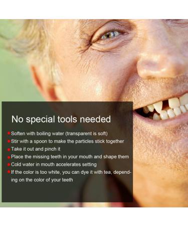 Temporary Tooth Repair Beads - 10g Filling Material for Missing/Broken Teeth - Replacement Kit - Buy Online on GoSupps.com