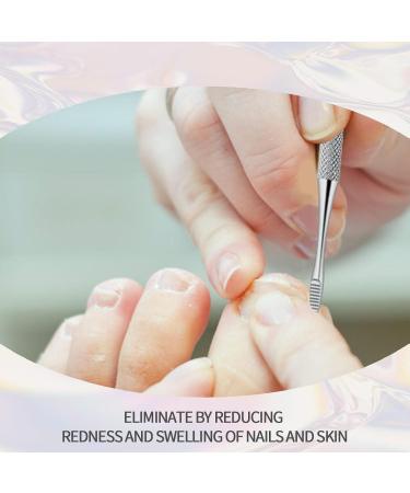 MFCGHXR Nail Care Toenail Correction Patch Set of 124 Includes Patch Nail Stickers File Lifter & Remover Black L - Buy Online on GoSupps.com